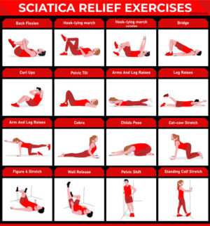 XYR7CCB6 Sciatica Relief Exercises